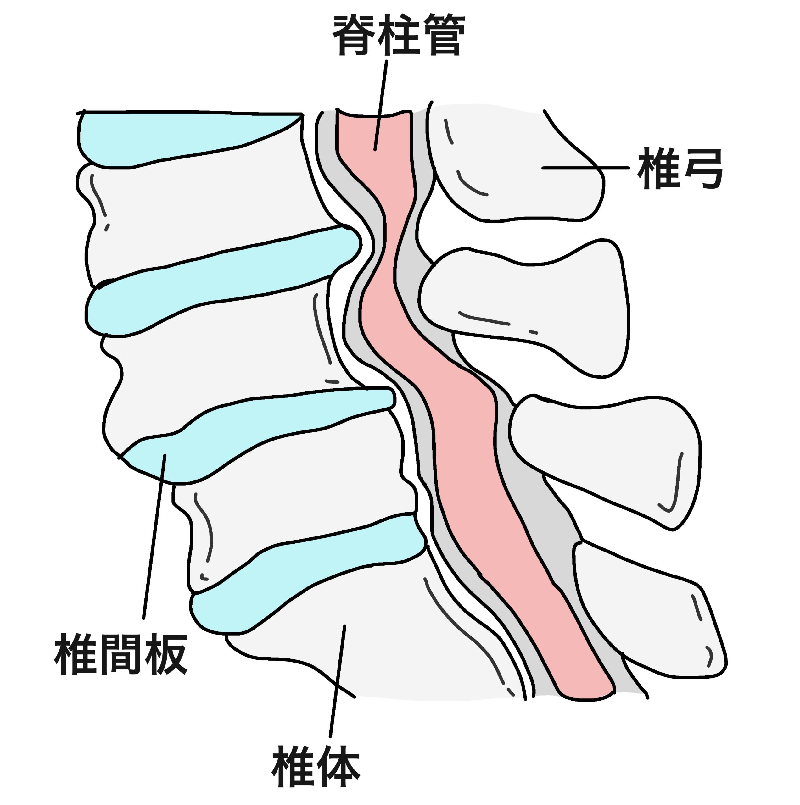 脊髄圧迫